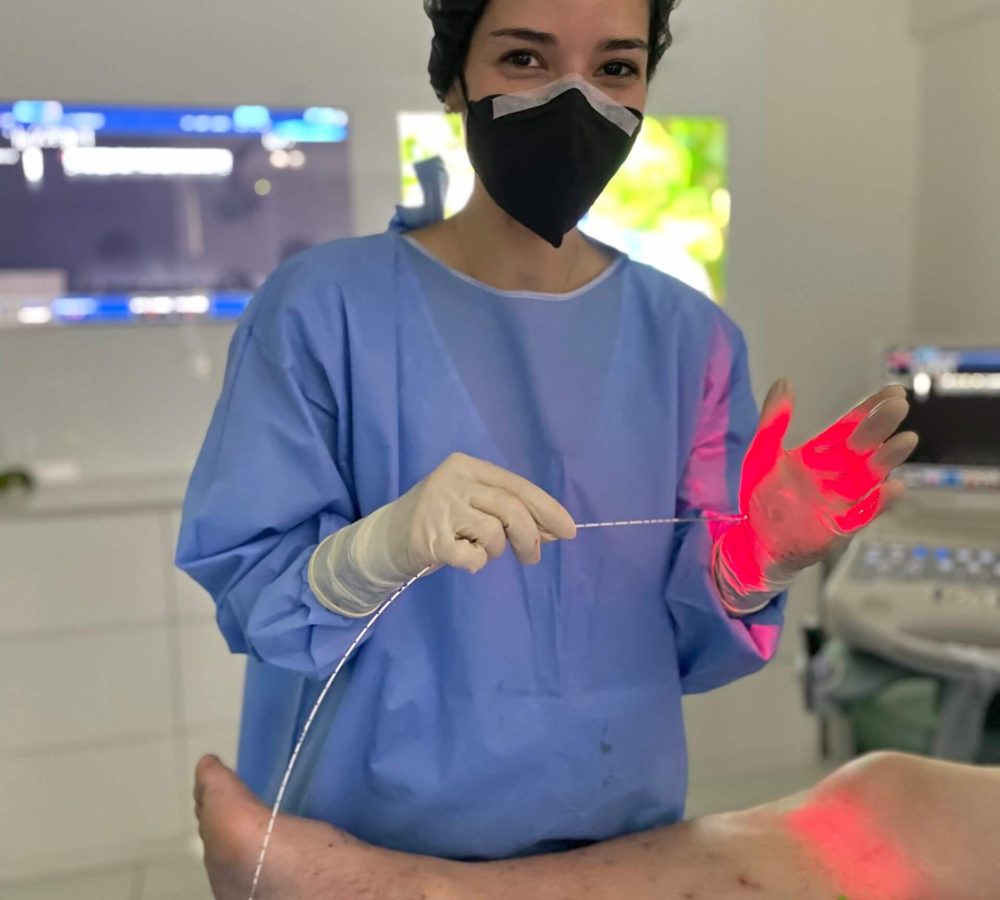 Cirurgia de varizes a laser Cirurgia de varizes a laser