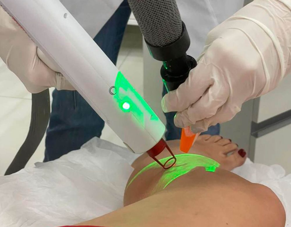 Laser Transdérmico